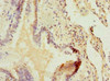 Immunohistochemistry of paraffin-embedded human lung tissue using CSB-PA861196LA01HU at dilution of 1:100