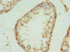 Immunohistochemistry of paraffin-embedded human testis tissue using CSB-PA861987LA01HU at dilution of 1:100