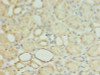 Immunohistochemistry of paraffin-embedded human kidney tissue using CSB-PA861987LA01HU at dilution of 1:100