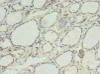 Immunohistochemistry of paraffin-embedded human thyroid tissue using CSB-PA862008LA01HU at dilution of 1:100