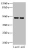 Western blot<br />
 All lanes: ZDHHC6 antibody at 0.2µg/ml<br />
 Lane 1: NIH/3T3 whole cell lysate<br />
 Lane 2: K562 whole cell lysate<br />
 Secondary<br />
 Goat polyclonal to rabbit IgG at 1/10000 dilution<br />
 Predicted band size: 48 kDa<br />
 Observed band size: 48 kDa<br />