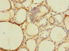 Immunohistochemistry of paraffin-embedded human thyroid tissue using CSB-PA862040LA01HU at dilution of 1:100