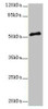 Western blot<br />
 All lanes: PLXNA4 antibody at 3µg/ml + A549 whole cell lysate<br />
 Secondary<br />
 Goat polyclonal to rabbit IgG at 1/10000 dilution<br />
 Predicted band size: 213, 56, 59, 40 kDa<br />
 Observed band size: 56 kDa<br />