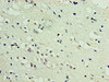 Immunohistochemistry of paraffin-embedded human brain tissue using CSB-PA863102HA01HU at dilution of 1:100