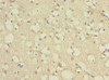 Immunohistochemistry of paraffin-embedded human brain tissue using CSB-PA863109LA01HU at dilution of 1:100