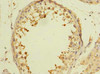 Immunohistochemistry of paraffin-embedded human testis tissue using CSB-PA863119LA01HU at dilution of 1:100