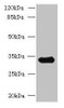 Western blot<br />
 All lanes: CCDC106 antibody at 4µg/ml + Mouse brain tissue<br />
 Secondary<br />
 Goat polyclonal to rabbit IgG at 1/10000 dilution<br />
 Predicted band size: 33 kDa<br />
 Observed band size: 33 kDa<br />