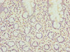 Immunohistochemistry of paraffin-embedded human small intestine tissue using CSB-PA863150LA01HU at dilution of 1:100