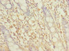 Immunohistochemistry of paraffin-embedded human colon tissue using CSB-PA863929LA01HU at dilution of 1:100
