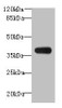 Western blot<br />
 All lanes: ASB7 antibody at 8µg/ml + A431 whole cell lysate<br />
 Secondary<br />
 Goat polyclonal to rabbit IgG at 1/10000 dilution<br />
 Predicted band size: 37, 31 kDa<br />
 Observed band size: 37 kDa<br /> Western blot<br />
 All lanes: ASB7 antibody at 8µg/ml + A431 whole cell lysate<br />
 Secondary<br />
 Goat polyclonal to rabbit IgG at 1/10000 dilution<br />
 Predicted band size: 37, 31 kDa<br />
 Observed band size: 37 kDa<br />