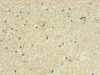 Immunohistochemistry of paraffin-embedded human brain tissue using CSB-PA863989EA01HU at dilution of 1:100