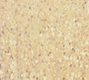 Immunohistochemistry of paraffin-embedded human adrenal gland tissue using CSB-PA863998LA01HU at dilution of 1:100