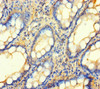 Immunohistochemistry of paraffin-embedded human small intestine tissue using CSB-PA864015LA01HU at dilution of 1:100 Immunohistochemistry of paraffin-embedded human small intestine tissue using CSB-PA864015LA01HU at dilution of 1:100
