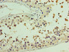 Immunohistochemistry of paraffin-embedded human testis tissue using CSB-PA865121LA01HU at dilution of 1:100