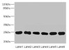 Western blot<br />
 All lanes: FKBP14 antibody at 1µg/ml<br />
 Lane 1: Mouse stomach tissue<br />
 Lane 2: Mouse gonadal tissue<br />
 Lane 3: U937 whole cell lysate<br />
 Lane 4: PC-3 whole cell lysate<br />
 Lane 5: 293T whole cell lysate<br />
 Lane 6: THP-1 whole cell lysate<br />
 Secondary<br />
 Goat polyclonal to rabbit IgG at 1/10000 dilution<br />
 Predicted band size: 25 kDa<br />
 Observed band size: 25 kDa<br />