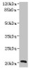 Western blot<br />
 All lanes: NICN1 antibody at 4µg/ml + U937 whole cell lysate<br />
 Secondary<br />
 Goat polyclonal to rabbit IgG at 1/10000 dilution<br />
 Predicted band size: 25, 20 kDa<br />
 Observed band size: 20 kDa<br />