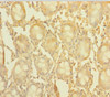 Immunohistochemistry of paraffin-embedded human colon tissue using CSB-PA866295LA01HU at dilution of 1:100