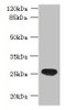 Western blot<br />
 All lanes: ENKD1 antibody at 7µg/ml + Mouse brain tissue<br />
 Secondary<br />
 Goat polyclonal to rabbit IgG at 1/10000 dilution<br />
 Predicted band size: 39, 26 kDa<br />
 Observed band size: 26 kDa<br />