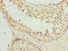 Immunohistochemistry of paraffin-embedded human testis tissue using CSB-PA867128LA01HU at dilution of 1:100