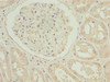 Immunohistochemistry of paraffin-embedded human kidney tissue using CSB-PA867148LA01HU at dilution of 1:100