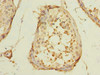 Immunohistochemistry of paraffin-embedded human testis tissue using CSB-PA868333LA01HU at dilution of 1:100 Immunohistochemistry of paraffin-embedded human testis tissue using CSB-PA868333LA01HU at dilution of 1:100