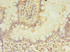Immunohistochemistry of paraffin-embedded human small intestine tissue using CSB-PA868341LA01HU at dilution of 1:100