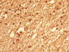 Immunohistochemistry of paraffin-embedded human brain tissue using CSB-PA868394LA01HU at dilution of 1:100