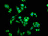 Immunofluorescence staining of PC-3 cells with CSB-PA871557LA01HU at 1:133, counter-stained with DAPI. The cells were fixed in 4% formaldehyde, permeabilized using 0.2% Triton X-100 and blocked in 10% normal Goat Serum. The cells were then incubated with the antibody overnight at 4°C. The secondary antibody was Alexa Fluor 488-congugated AffiniPure Goat Anti-Rabbit IgG (H+L) .