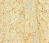 Immunohistochemistry of paraffin-embedded human adrenal gland tissue using CSB-PA871563LA01HU at dilution of 1:100