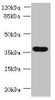 Western blot<br />
 All lanes: TRIM51 antibody at 1.2µg/ml + Jurkat whole cell lysate<br />
 Secondary<br />
 Goat polyclonal to rabbit IgG at 1/10000 dilution<br />
 Predicted band size: 53, 36 kDa<br />
 Observed band size: 36 kDa<br />