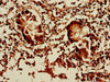 Immunohistochemistry of paraffin-embedded human appendix tissue using CSB-PA871573LA01HU at dilution of 1:100