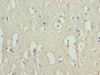 Immunohistochemistry of paraffin-embedded human brain tissue using CSB-PA871590LA01HU at dilution of 1:100