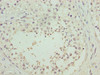 Immunohistochemistry of paraffin-embedded human testis tissue using CSB-PA871590LA01HU at dilution of 1:100