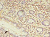 Immunohistochemistry of paraffin-embedded human small intestine tissue using CSB-PA872517LA01HU at dilution of 1:100