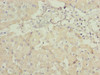 Immunohistochemistry of paraffin-embedded human liver tissue using CSB-PA872524LA01HU at dilution of 1:100