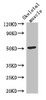 Western Blot<br />
 Positive WB detected in: Mouse skeletal muscle tissue<br />
 All lanes: TUBG2 antibody at 3µg/ml<br />
 Secondary<br />
 Goat polyclonal to rabbit IgG at 1/50000 dilution<br />
 Predicted band size: 52 kDa<br />
 Observed band size: 52 kDa<br />