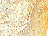 Immunohistochemistry of paraffin-embedded human tonsil tissue using CSB-PA873727LA01HU at dilution of 1:100