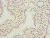 Immunohistochemistry of paraffin-embedded human small intestine tissue using CSB-PA874810LA01HU at dilution of 1:100 Immunohistochemistry of paraffin-embedded human small intestine tissue using CSB-PA874810LA01HU at dilution of 1:100