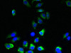 Immunofluorescent analysis of A549 cells using CSB-PA874810LA01HU at dilution of 1:100 and Alexa Fluor 488-congugated AffiniPure Goat Anti-Rabbit IgG (H+L) Immunofluorescent analysis of A549 cells using CSB-PA874810LA01HU at dilution of 1:100 and Alexa Fluor 488-congugated AffiniPure Goat Anti-Rabbit IgG (H+L)