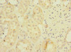 Immunohistochemistry of paraffin-embedded human kidney tissue using CSB-PA874814LA01HU at dilution of 1:100