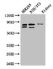 Western Blot<br />
 Positive WB detected in: HEK293 whole cell lysate, NIH/3T3 whole cell lysate, Mouse lung tissue<br />
 All lanes: NUP85 antibody at 2.7µg/ml<br />
 Secondary<br />
 Goat polyclonal to rabbit IgG at 1/50000 dilution<br />
 Predicted band size: 76, 53, 70 kDa<br />
 Observed band size: 76, 70 kDa<br />