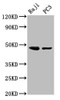 Western Blot<br />
 Positive WB detected in: Raji whole cell lysate, PC-3 whole cell lysate<br />
 All lanes: STRADB antibody at 3µg/ml<br />
 Secondary<br />
 Goat polyclonal to rabbit IgG at 1/50000 dilution<br />
 Predicted band size: 48, 43, 32 kDa<br />
 Observed band size: 48 kDa<br />