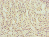 Immunohistochemistry of paraffin-embedded human adrenal gland tissue using CSB-PA875629LA01HU at dilution of 1:100