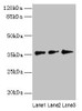 Western blot<br />
 All lanes: LDAH antibody at 8µg/ml<br />
 Lane 1: Hela whole cell lysate<br />
 Lane 2: Jurkat whole cell lysate<br />
 Lane 3: A431 whole cell lysate<br />
 Secondary<br />
 Goat polyclonal to rabbit IgG at 1/10000 dilution<br />
 Predicted band size: 38, 33, 23 kDa<br />
 Observed band size: 38 kDa<br />