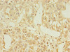 Immunohistochemistry of paraffin-embedded human adrenal gland tissue using CSB-PA875685LA01HU at dilution of 1:100