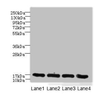 Western blot<br />
 All lanes: PLGRKT antibody at 6µg/ml<br />
 Lane 1: A431 whole cell lysate<br />
 Lane 2: Mouse lung tissue<br />
 Lane 3: NIH/3T3 whole cell lysate<br />
 Lane 4: U251 whole cell lysate<br />
 Secondary<br />
 Goat polyclonal to rabbit IgG at 1/10000 dilution<br />
 Predicted band size: 18 kDa<br />
 Observed band size: 18 kDa<br />