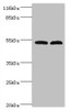 Western blot<br />
 All lanes: Protein FAM114A2 antibody at 2µg/ml<br />
 Lane 1: Mouse kidney tissue<br />
 Lane 2: U251 whole cell lysate<br />
 Secondary<br />
 Goat polyclonal to rabbit IgG at 1/10000 dilution<br />
 Predicted band size: 55 kDa<br />
 Observed band size: 55 kDa<br />