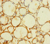 Immunohistochemistry of paraffin-embedded human thyroid tissue using CSB-PA878881LA01HU at dilution of 1:100