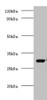 Western blot<br />
 All lanes: COP9 signalosome complex subunit 7a antibody at 2µg/ml + Mouse brain tissue<br />
 Secondary<br />
 Goat polyclonal to rabbit IgG at 1/10000 dilution<br />
 Predicted band size: 30 kDa<br />
 Observed band size: 30 kDa<br />