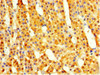 Immunohistochemistry of paraffin-embedded human adrenal gland tissue using CSB-PA880068HA01HU at dilution of 1:100